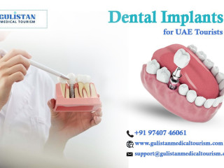 Bangalore’s Trusted Dental Implant Services for UAE Tourists – Gulistan