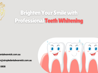 Brighten Your Smile with Professional Teeth Whitening