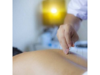 Effective And Natural Healing At Northshore Acupuncture Center In North Vancouver