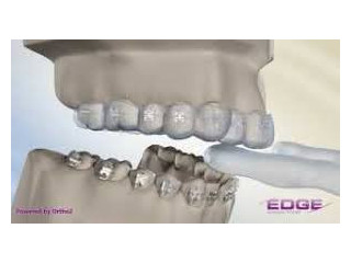 Lethbridge Smiles Start Here - Gibb Orthodontics