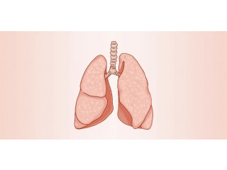 Lung Transplant Success Rate In Delhi
