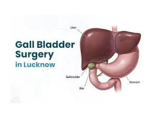 Expert Gall Bladder Surgery Services in Your City