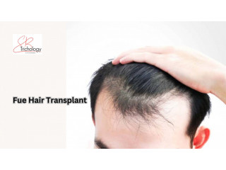 FUE Hair Transplant In Gurgaon - SB Trichology