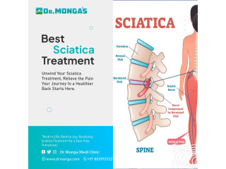 Best Sciatica Pain Treatment in Delhi | 8010931122