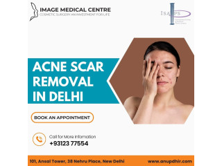 Acne Scar Removal in Delhi- Dr. Anup Dhir