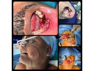 Maxillofacial and Oral Onco Surgeon in Kolkata
