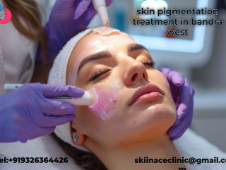 Skin pigmentation treatment in bandra west | Skiin Ace Clinic