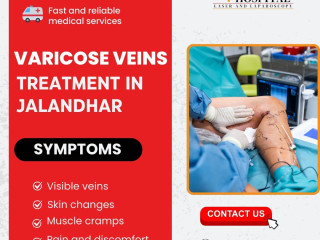 Get Relief with Varicose Veins Treatment in Jalandhar by AksharHospital