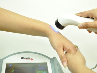 Cold Laser Therapy