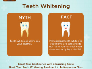 Best Teeth Whitening Treatment in Indirapuram