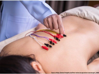 From Traditional to Tech: How Electroacupuncture is Transforming Wellness in Mumbai!!