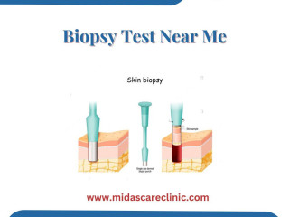 Find Reliable Biopsy Testing Near You