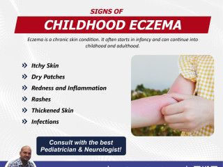 Is Your Child Suffering from Eczema?