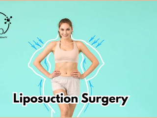 Best Liposuction Surgery In Hyderabad