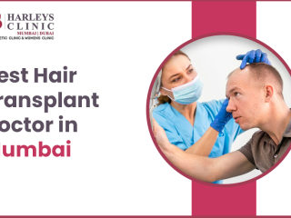 Best hair transplant in Mumbai