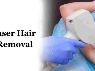 Affordable Laser Hair Removal in Bangalore