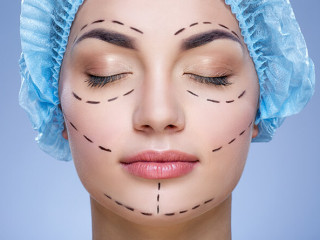 Facelift Surgery Cost In Delhi