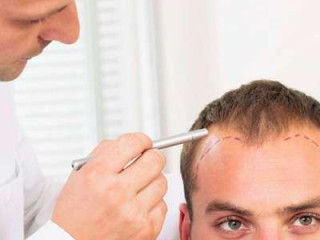 FUT Hair Transplant in Mumbai