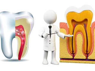 UNDERSTANDING THE ROOT CANAL PROCEDURE: WHAT PATIENTS IN THANE NEED TO KNOW