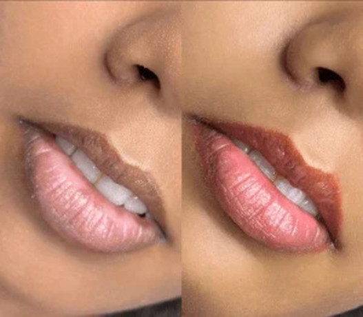 get-perfect-lip-correction-in-thane-victress-beauty-lounge-big-0