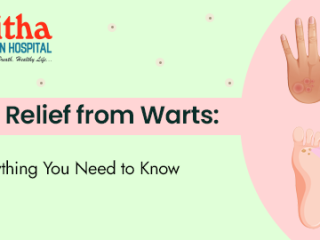 Warts Exposed: Causes, Symptoms, and Treatment Solutions