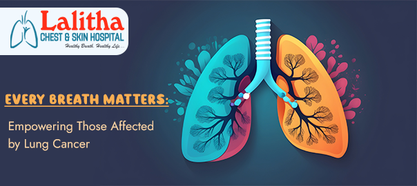 lung-cancer-understanding-symptoms-types-treatment-options-big-0