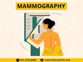 Affordable Mammography Test Prices: What to Expect & How to Save