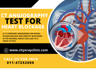 CT Coronary Scan Price Guide: What to Expect