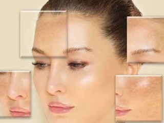 Best Skin Care Clinic in Bangalore - Dermaqure