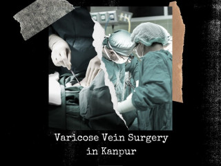 Varicose Vein Surgery in Kanpur at Fortune Hospital