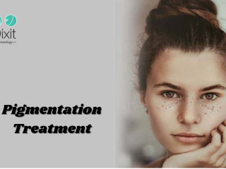 Pigmentation Treatment In Bangalore