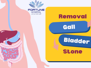 Quick and Safe Gall Bladder Stone Removal at Fortune Hospital