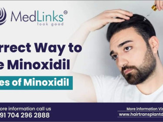 Correct Way to Use Minoxidil | Types of Minoxidil