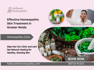 Get Healthy Skin Naturally with Homeopathic Skin Treatment in Greater Noida