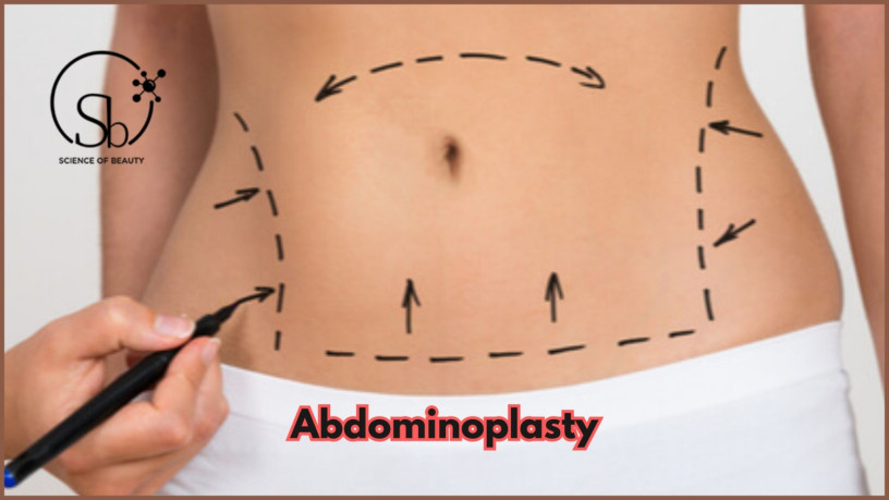 abdominoplasty-in-hyderabad-big-0