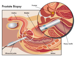 Best Urology Near Me – Kapoor's Kidney & Urostone Centre