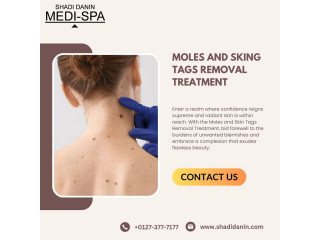 Are Moles and Skin Tags Affecting Your Confidence?