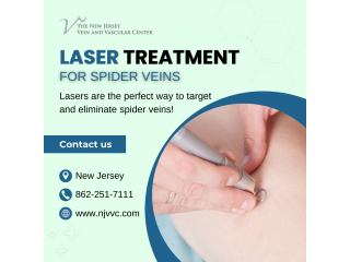 Laser Treatment for Spider Veins in NJ