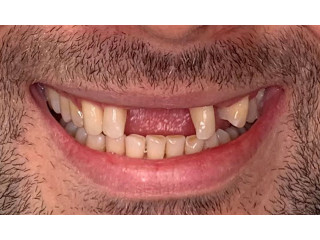 VIP Dental Implants Houston | Board-Certified Periodontist,,,