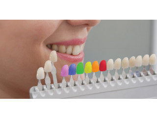 Tooth Colored Fillings Perris | Dental Fillings in California | Nuevo
