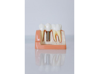 Enamel Dentistry Saltillo: Your Good Dentist in Austin