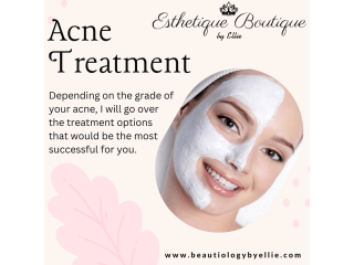 Esthetician for Acne Treatment in Los Angeles California