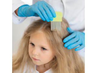 Expert Lice Treatment: Fast, Safe, and Effective Solutions