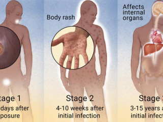 STD Home Test Kits | HIV Test Kits