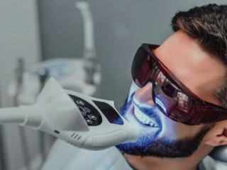 Affordable Professional Teeth Whitening | Brighten Your Smile at a Great Price