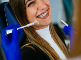 Braces In Raleigh For A Perfect Smile