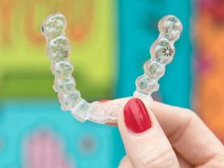 Invisalign San Diego | Clear Braces at Mesa Dental